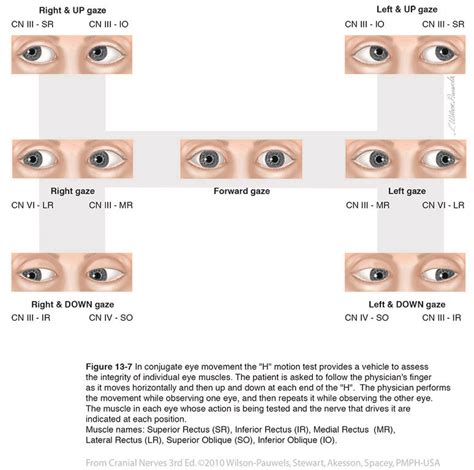 torsion eye test|sensory motor testing eyes.